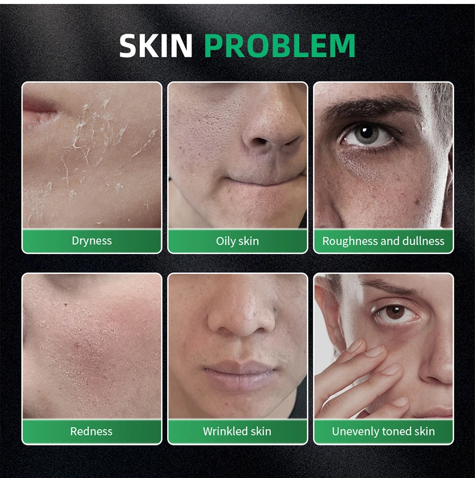 Men Skincare Deep Cleansing Face Wash Oil Control kit - Image 2