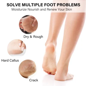 50Sets/Case FOOTNICE Spa Pedicure Kit - Thumbnail Image 3
